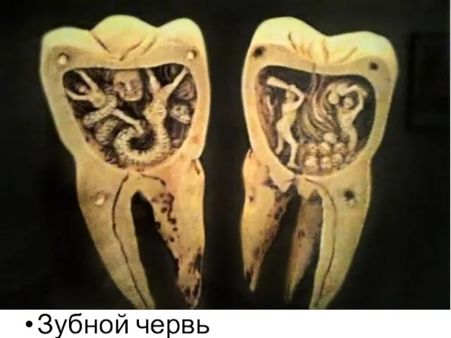 Зубной червь