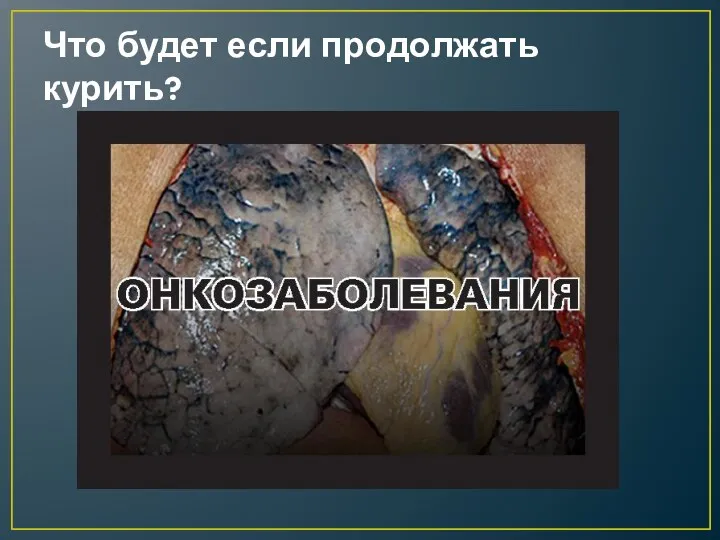 Что будет если продолжать курить?