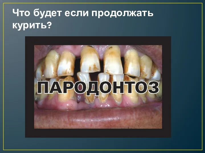 Что будет если продолжать курить?