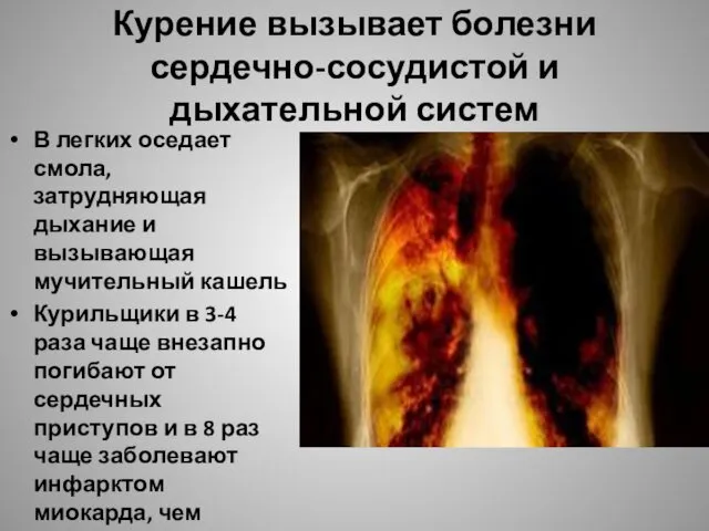 Курение вызывает болезни сердечно-сосудистой и дыхательной систем В легких оседает