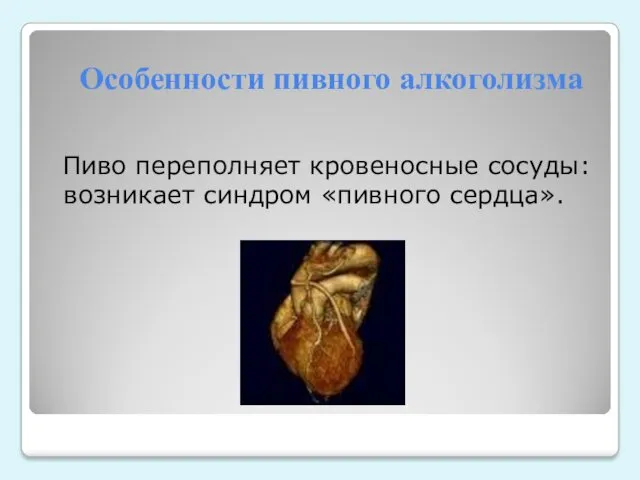 Особенности пивного алкоголизма Пиво переполняет кровеносные сосуды: возникает синдром «пивного сердца».