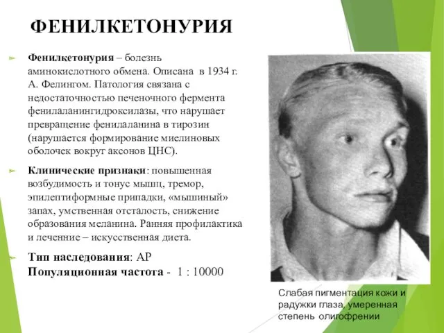 ФЕНИЛКЕТОНУРИЯ Фенилкетонурия – болезнь аминокислотного обмена. Описана в 1934 г.