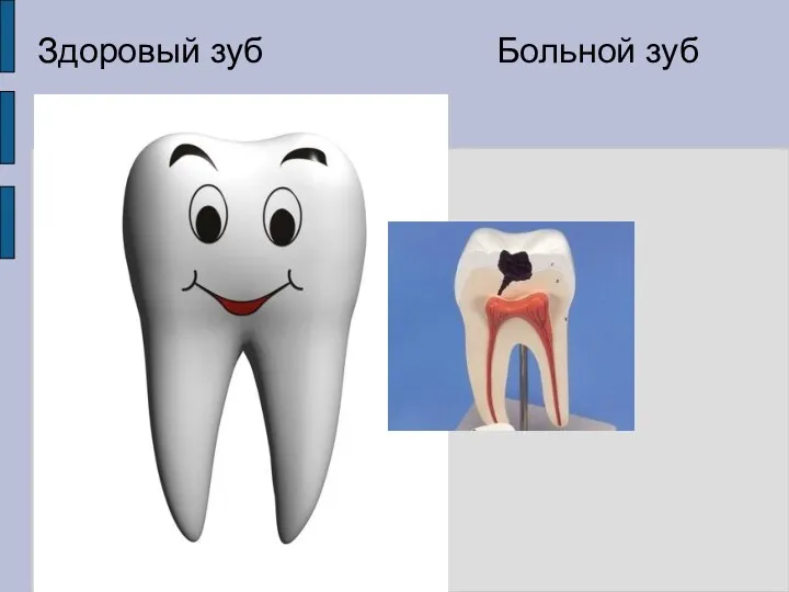 Здоровый зуб Больной зуб