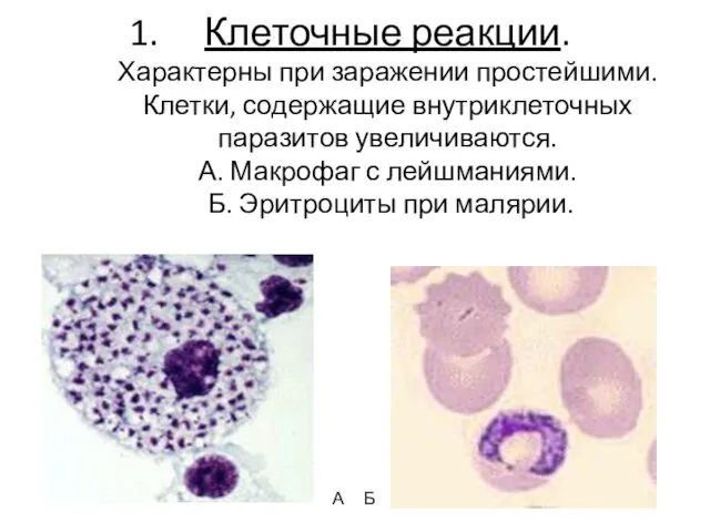 Клеточные реакции. Характерны при заражении простейшими. Клетки, содержащие внутриклеточных паразитов увеличиваются. А. Макрофаг