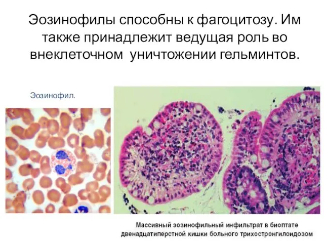 Эозинофилы способны к фагоцитозу. Им также принадлежит ведущая роль во внеклеточном уничтожении гельминтов. Эозинофил.