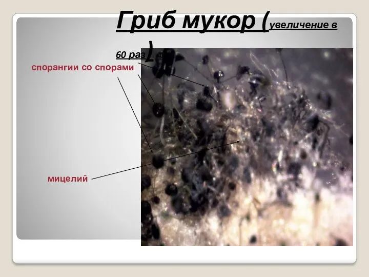 Гриб мукор (увеличение в 60 раз) спорангии со спорами мицелий