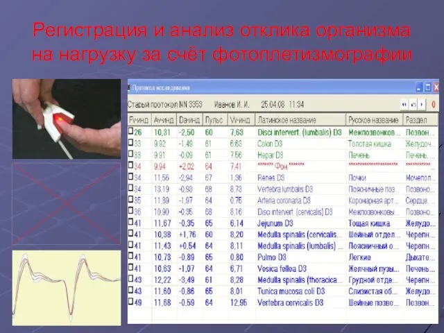 Регистрация и анализ отклика организма на нагрузку за счёт фотоплетизмографии