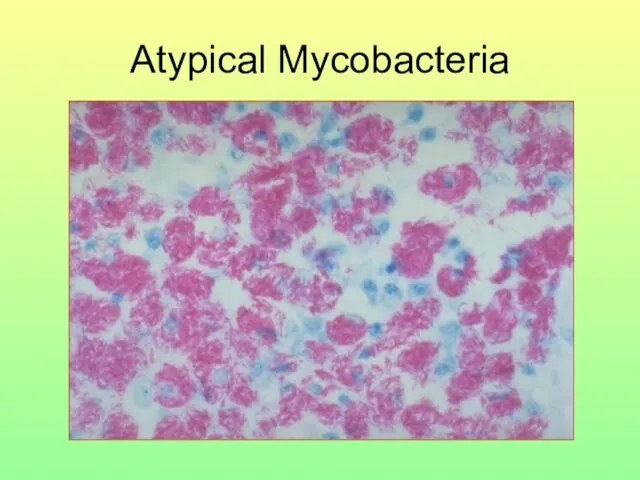 Atypical Mycobacteria