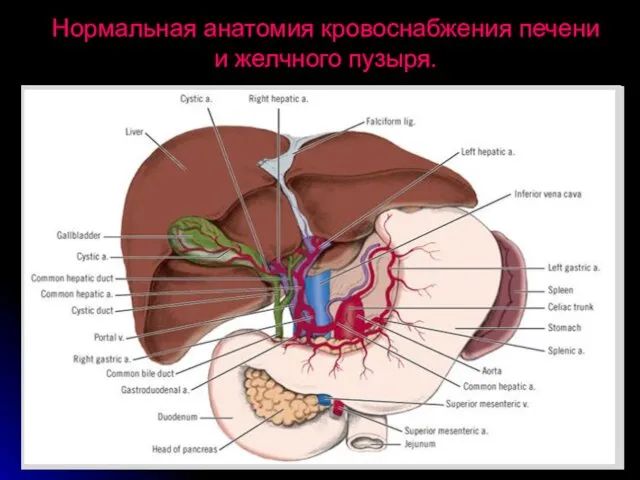 Нормальная анатомия кровоснабжения печени и желчного пузыря.
