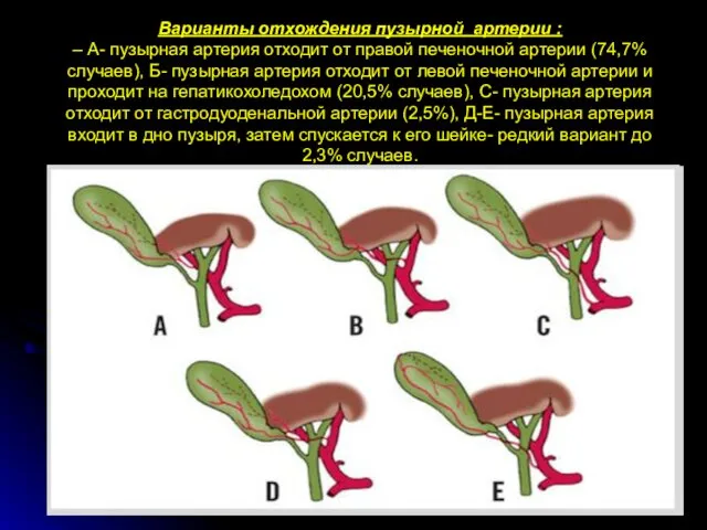 Варианты отхождения пузырной артерии : – А- пузырная артерия отходит