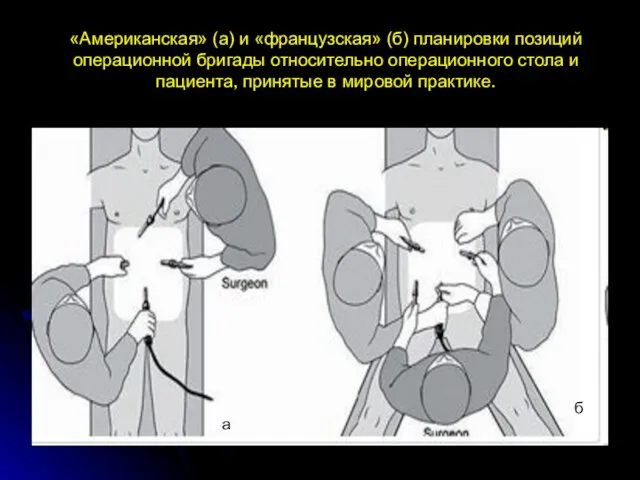 «Американская» (а) и «французская» (б) планировки позиций операционной бригады относительно