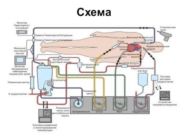 Схема