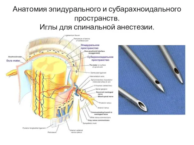 Анатомия эпидурального и субарахноидального пространств. Иглы для спинальной анестезии.