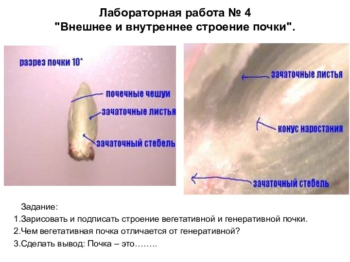 Лабораторная работа № 4 "Внешнее и внутреннее строение почки". Задание: