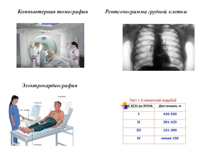 Компьютерная томография Электрокардиография Рентгенограмма грудной клетки