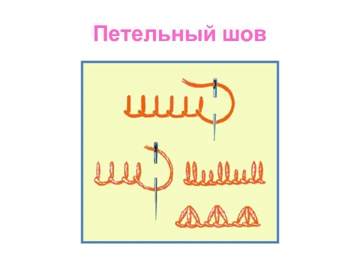 Петельный шов