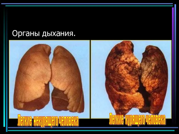 Органы дыхания. Легкие некурящего человека Легкие курящего человека