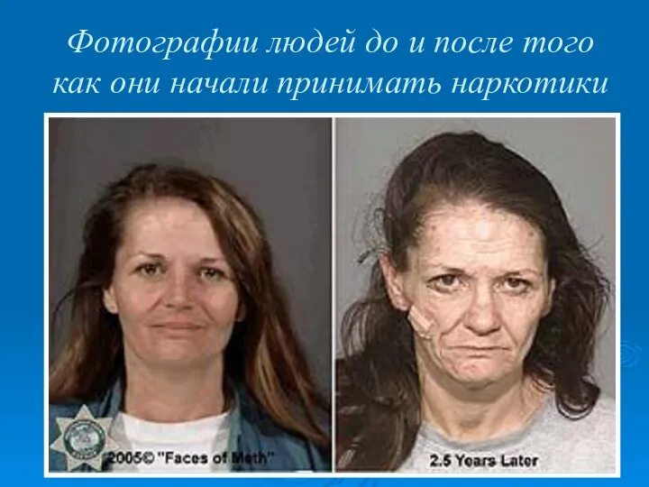 Фотографии людей до и после того как они начали принимать наркотики