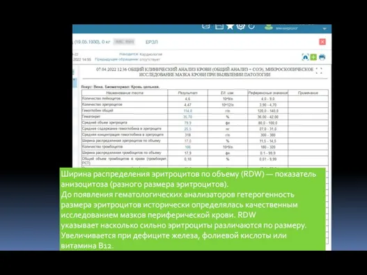 Ширина распределения эритроцитов по объему (RDW) — показатель анизоцитоза (разного