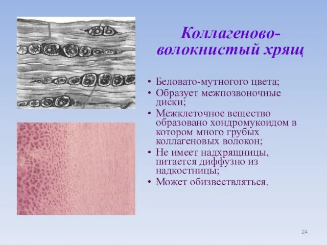 Коллагеново- волокнистый хрящ Беловато-мутногого цвета; Образует межпозвоночные диски; Межклеточное вещество