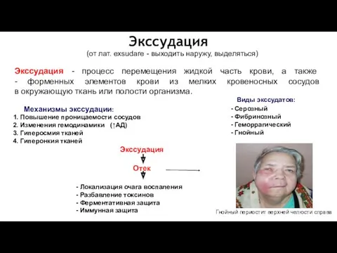 (от лат. exsudare - выходить наружу, выделяться) Экссудация - процесс