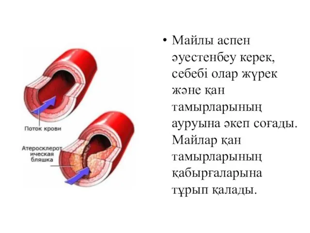 Майлы аспен әуестенбеу керек, себебі олар жүрек және қан тамырларының