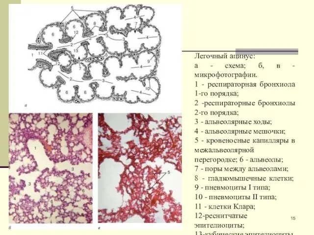 Легочный ацинус: а - схема; б, в - микрофотографии. 1