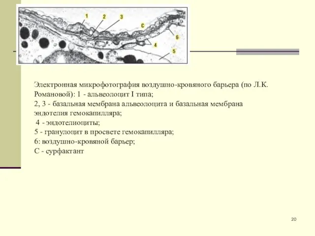 Электронная микрофотография воздушно-кровяного барьера (по Л.К. Романовой): 1 - альвеолоцит