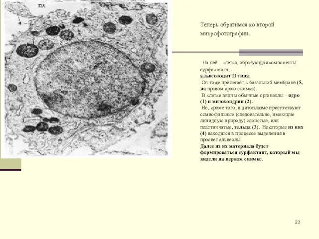 Теперь обратимся ко второй микрофотографии. На ней - клетка, образующая