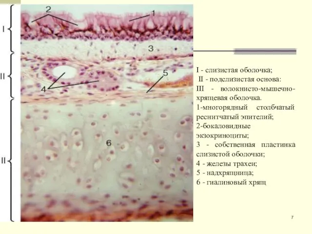 I - слизистая оболочка; II - подслизистая основа: III -