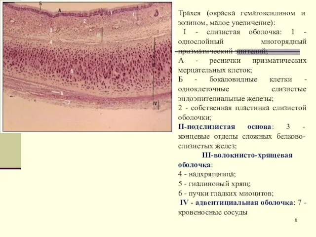 Трахея (окраска гематоксилином и эозином, малое увеличение): I - слизистая