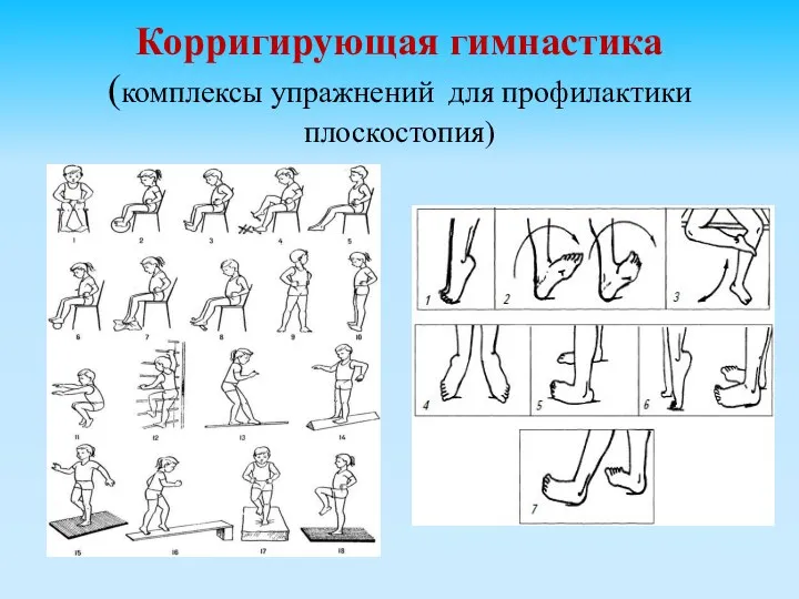 Корригирующая гимнастика (комплексы упражнений для профилактики плоскостопия)