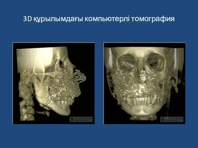 3D құрылымдағы компьютерлі томография