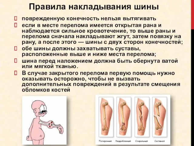 поврежденную конечность нельзя вытягивать если в месте перелома имеется открытая