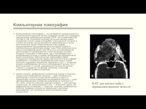 Компьютерная томография Компьютерная томография — по значимости приравнивается к открытию рентгеновских лучей. Свидетельством