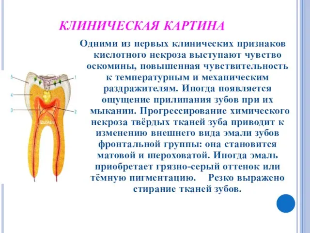 КЛИНИЧЕСКАЯ КАРТИНА Одними из первых клинических признаков кислотного некроза выступают