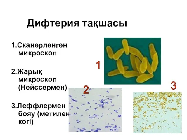 Дифтерия тақшасы 1.Сканерленген микроскоп 2.Жарық микроскоп (Нейссермен) 3.Леффлермен бояу (метилен көгі) 1 2 3