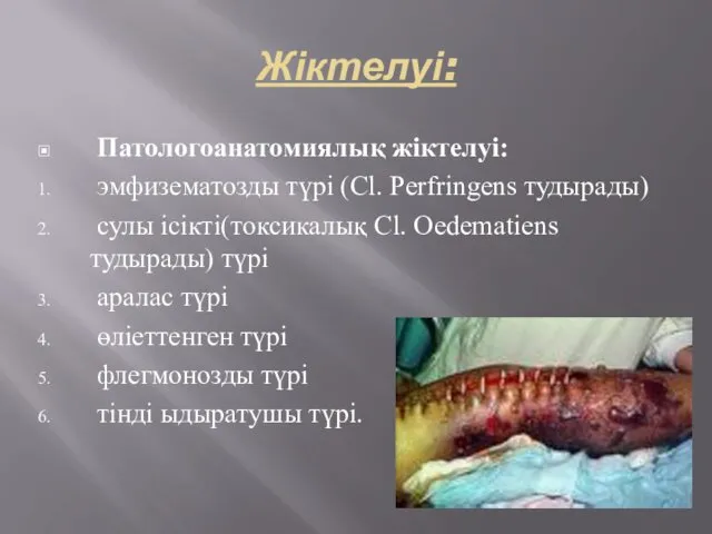 Жіктелуі: Патологоанатомиялық жіктелуі: эмфизематозды түрі (Cl. Perfringens тудырады) сулы ісікті(токсикалық Cl. Oedematiens тудырады)