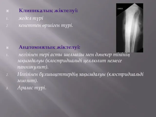 Клиникалық жіктелуі: жедел түрі кенеттен өршіген түрі. Анатомиялық жіктелуі: негізінен