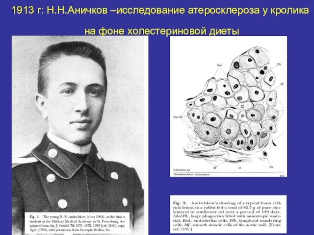 1913 г: Н.Н.Аничков –исследование атеросклероза у кролика на фоне холестериновой диеты
