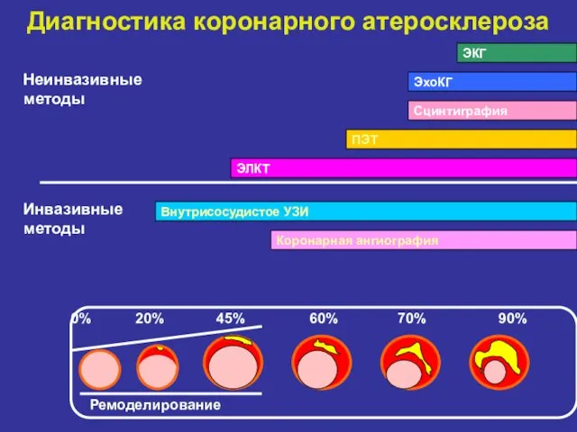 ЭКГ ЭхоКГ 0% 20% 45% 60% 70% 90% Диагностика коронарного