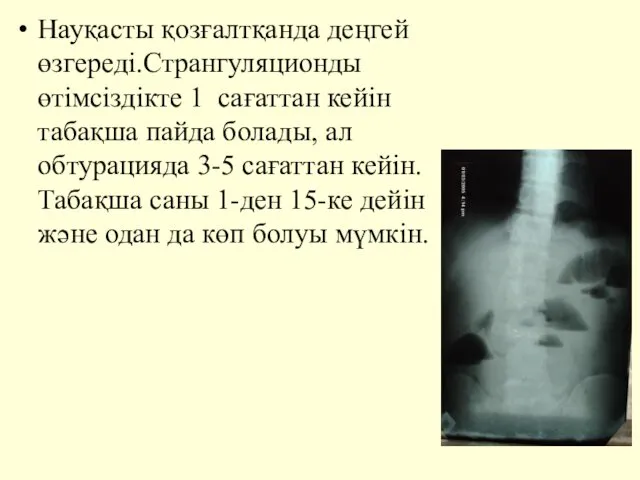 Науқасты қозғалтқанда деңгей өзгереді.Странгуляционды өтімсіздікте 1 сағаттан кейін табақша пайда