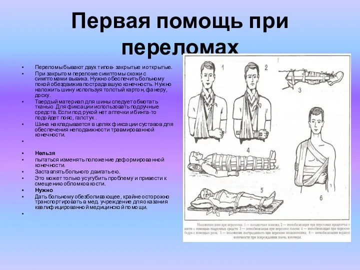 Первая помощь при переломах Переломы бывают двух типов- закрытые и открытые. При закрытом