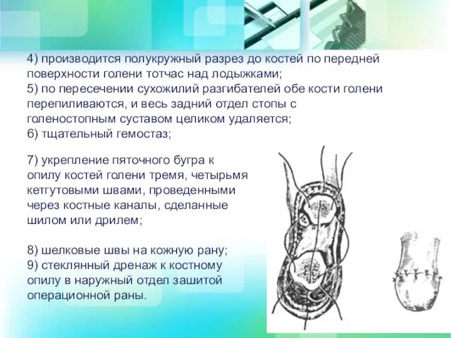 4) производится полукружный разрез до костей по передней поверхности голени