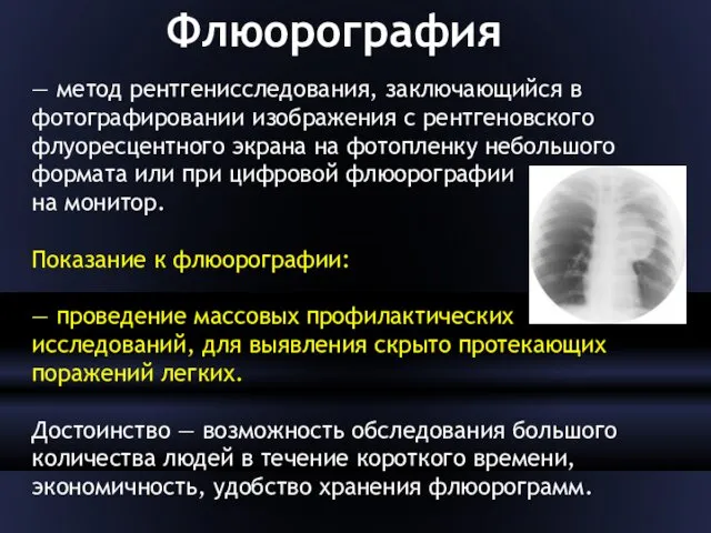 Флюорография — метод рентгенисследования, заключающийся в фотографировании изображения с рентгеновского флуоресцентного экрана на