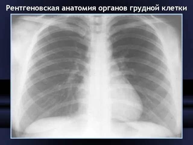 Рентгеновская анатомия органов грудной клетки