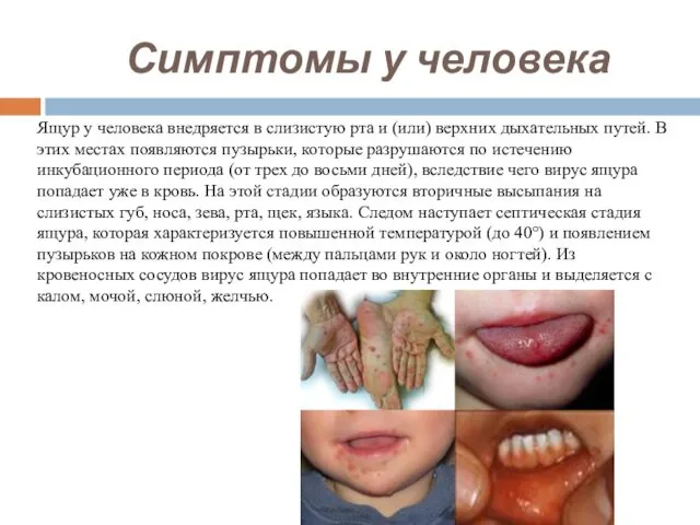 Симптомы у человека Ящур у человека внедряется в слизистую рта