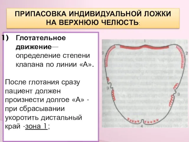 ПРИПАСОВКА ИНДИВИДУАЛЬНОЙ ЛОЖКИ НА ВЕРХНЮЮ ЧЕЛЮСТЬ: Глотательное движение—определение степени клапана