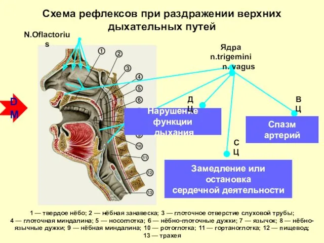 Схема рефлексов при раздражении верхних дыхательных путей 1 — твердое