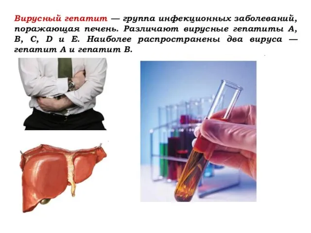 Вирусный гепатит — группа инфекционных заболеваний, поражающая печень. Различают вирусные